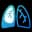 Pleural Effusion