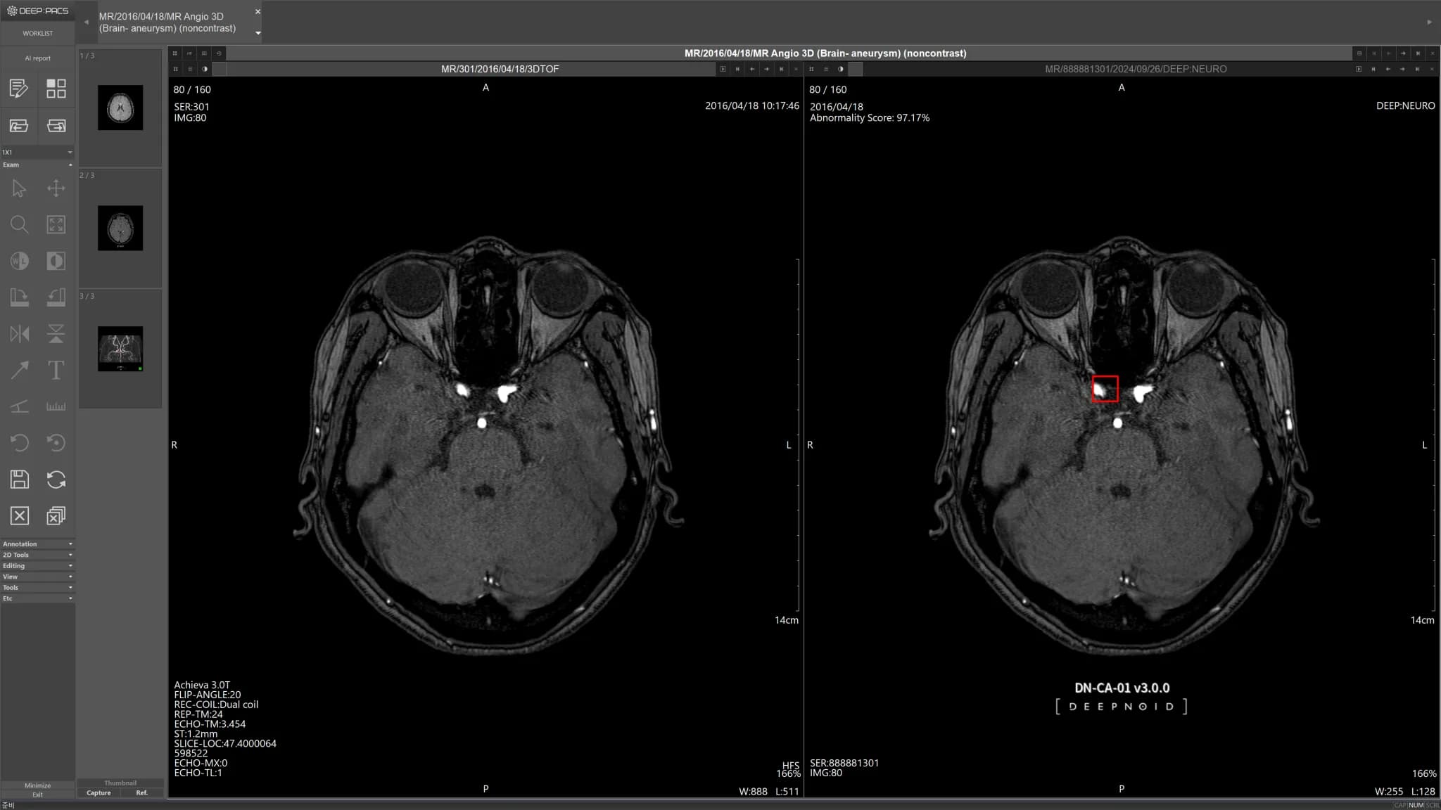 DEEP:NEURO Case 1