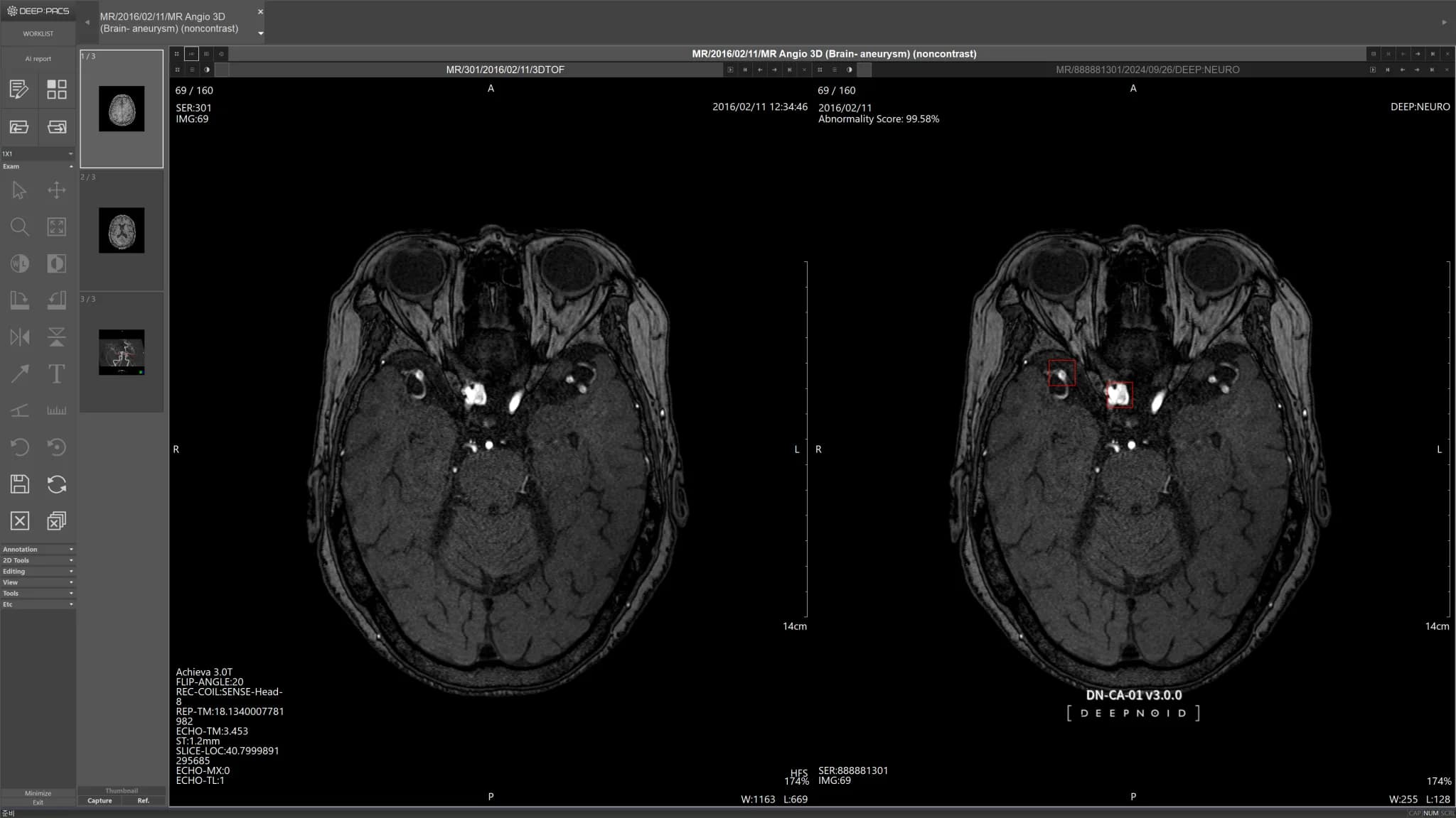 DEEP:NEURO Case 2