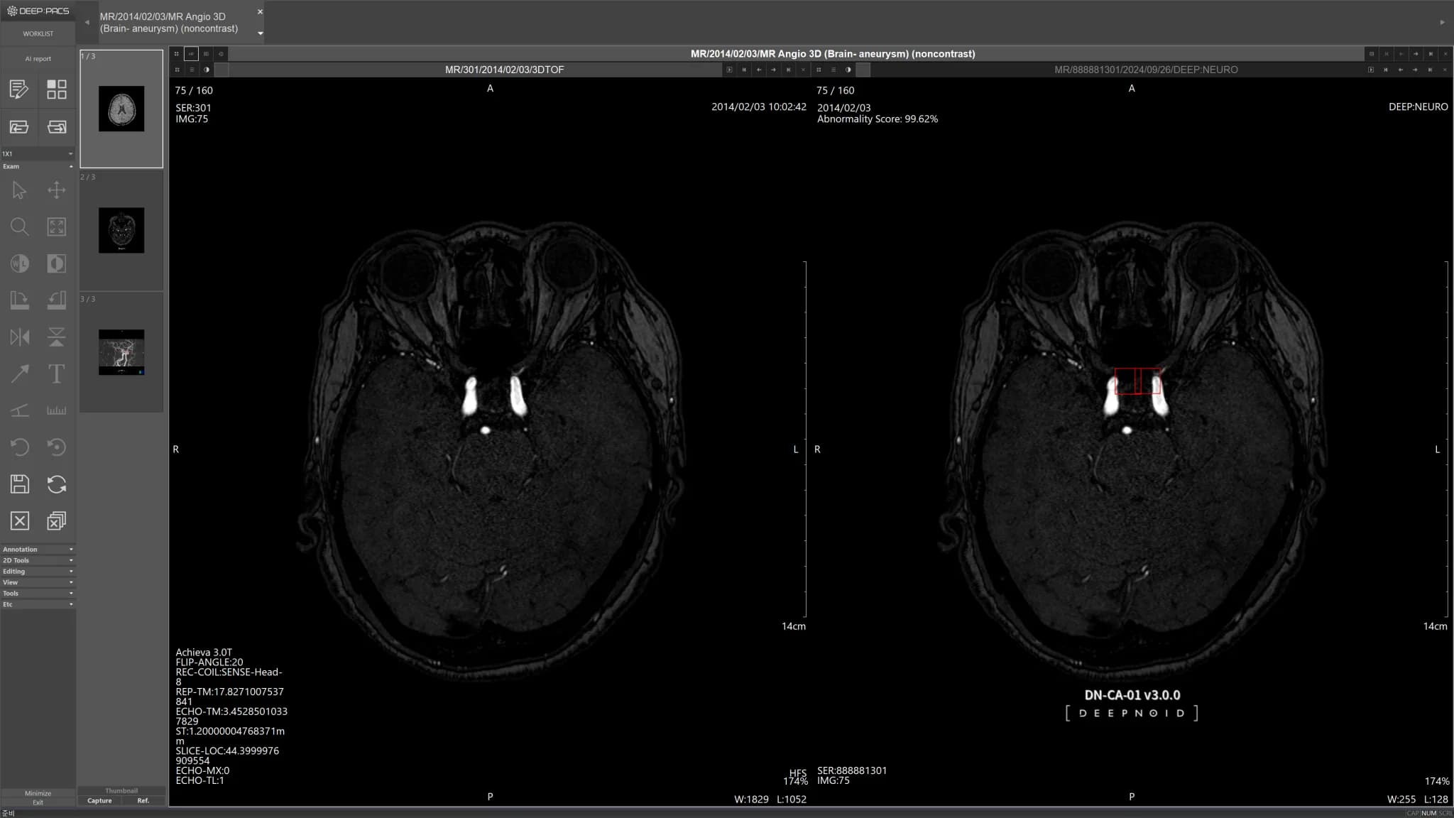 DEEP:NEURO Case 3