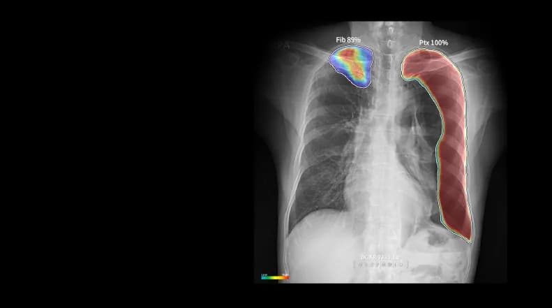 DEEP:CHEST