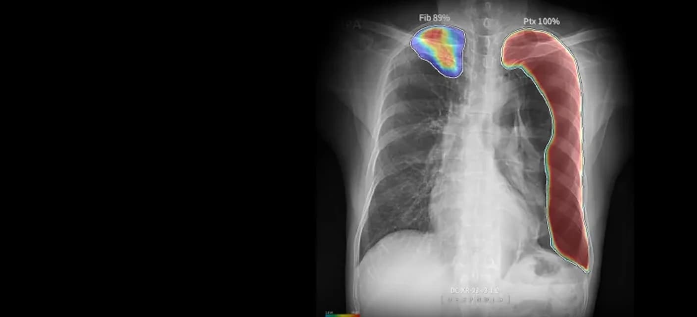 DEEP:CHEST