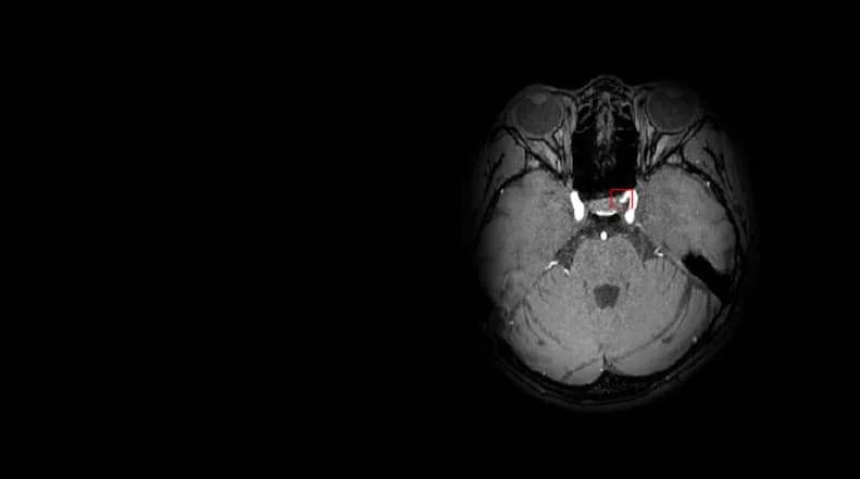 DEEP:NEURO
