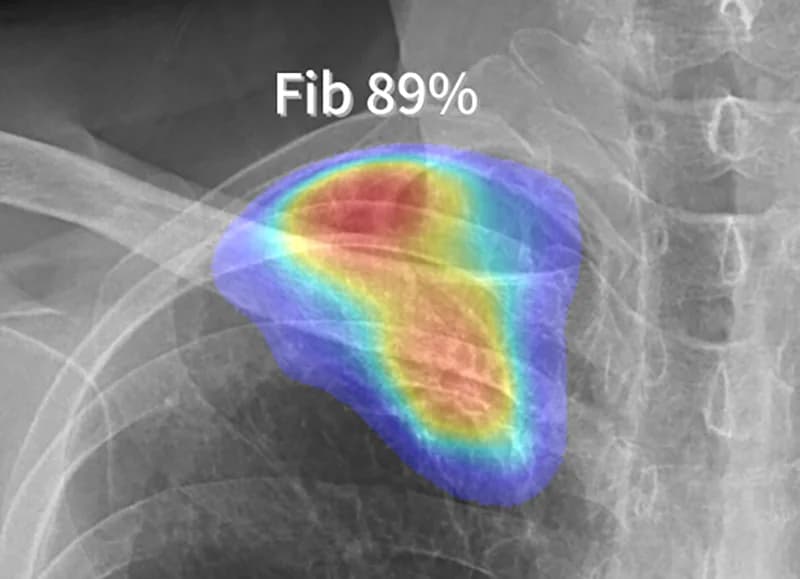 Heatmap