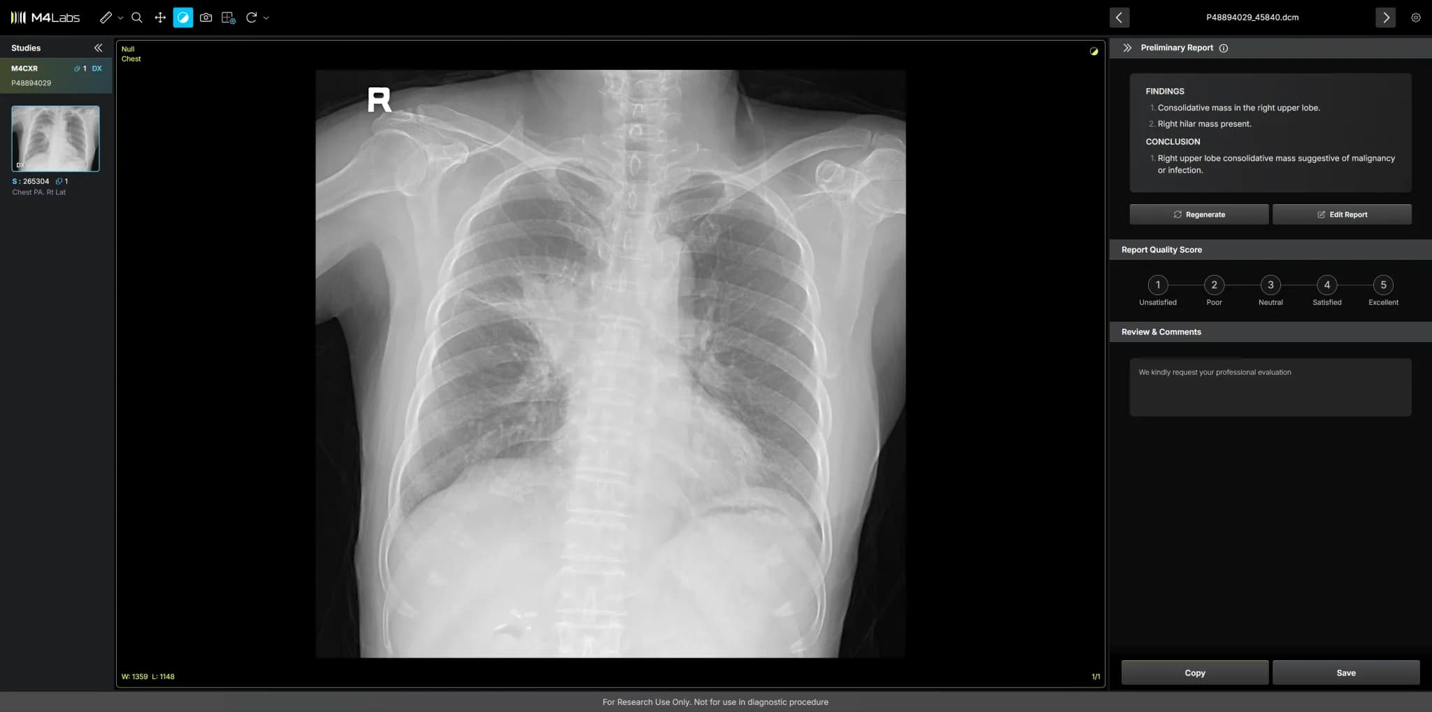 M4CXR Case 1