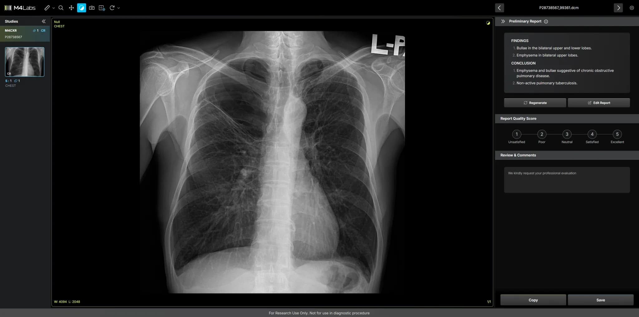 M4CXR Case 2