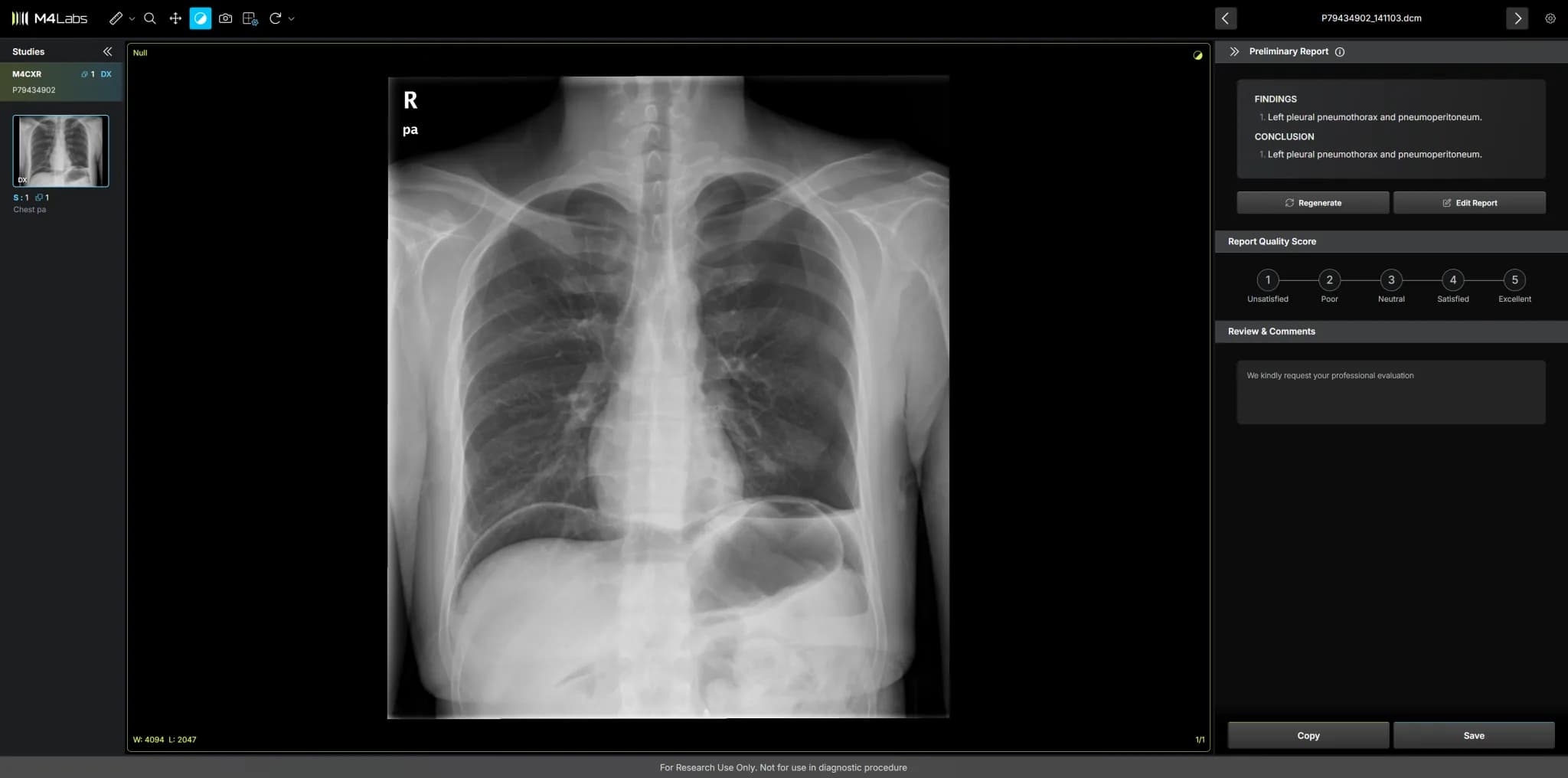 M4CXR Case 3