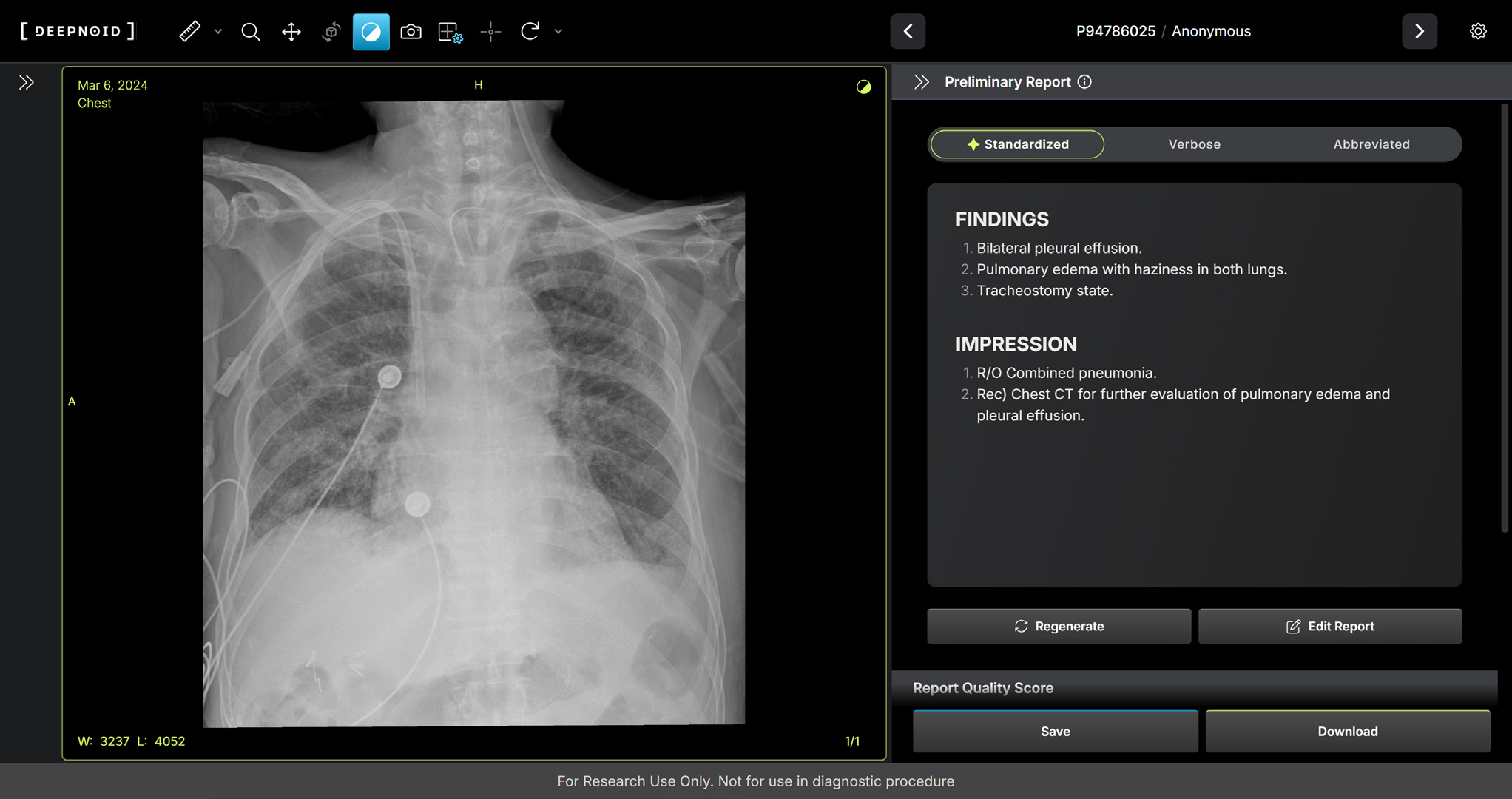 딥노이드, 생성형 AI ‘M4CXR’ 식약처 임상시험계획 승인… 의료AI 솔루션 상용화 탄력