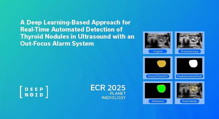 딥노이드, ECR 2025서 초록 채택…AI 기반 실시간 갑상선 결절 검출 기술 주목